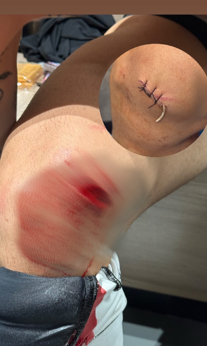 万博ManbetxAPP-马赛俱乐部球衣